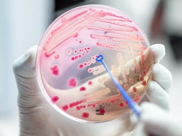 Close up of medical technician working on bacterial culture and drug resistance of pathogens in laboratory, photo by analysis121980/Adobe Stock