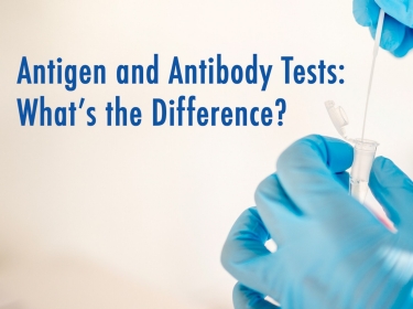 Antigen and Antibody Tests