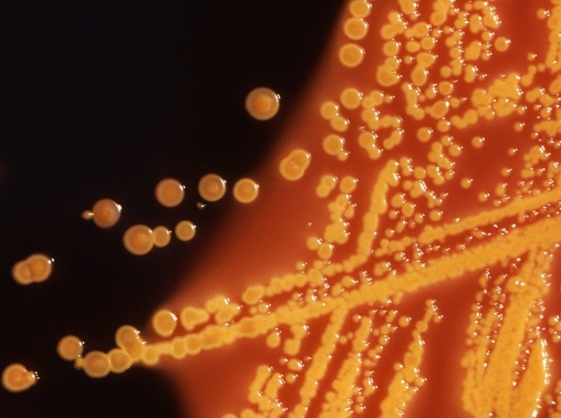 Colonies of E. coli bacteria grown on a Hektoen enteric agar plate