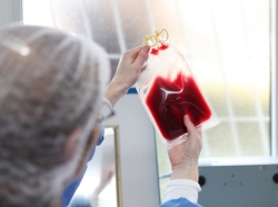 Doctor inspecting a blood bag