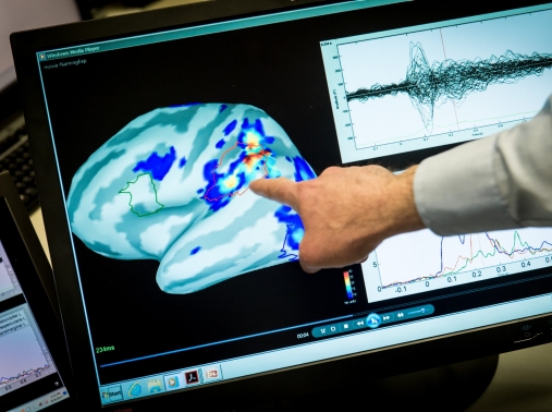 Laboratory scientist Mihai Popescu points out areas of magnetic activity in a brain on a display at the National Intrepid Center of Excellence at Walter Reed National Military Medical Center in Bethesda, Maryland