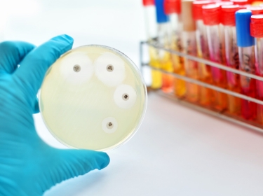 Antimicrobial susceptibility testing in petri dish, photo by  jarun011/Adobe Stock