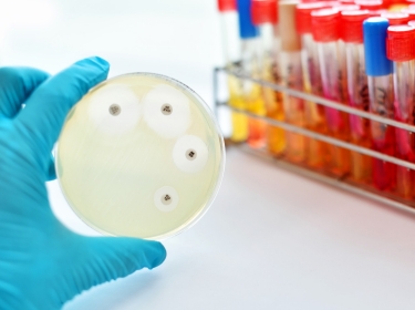 Antimicrobial susceptibility testing in petri dish, photo by  jarun011/Adobe Stock